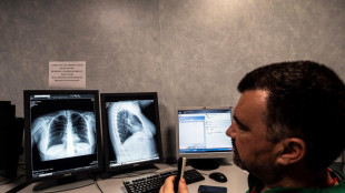 Tumore seno, cresce adesione a screening ma divario Nord-Sud