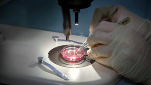 Endometriosi ed emicrania, possibile meccanismo comune malattie